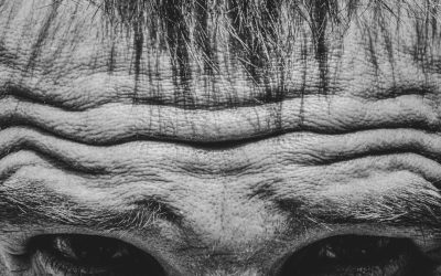 The Ultimate Guide to Forehead Wrinkle Before and After Transformations